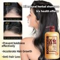 Polygonum Multiflorum Permanent Black Hair Oil Control Anti-dandruff Shampoo Nourishes Scalp Anti-hair Loss 750ml. 