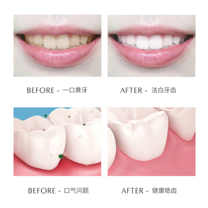 TVLV%20Whitening%20Diamond%20Toothpaste%20Whitening%20Teeth%20Mint%20Fresh%20Breath%20Gum%20Care%20Adult%20Day%20&%20Night%20Toothpaste%20-%20Image%204
