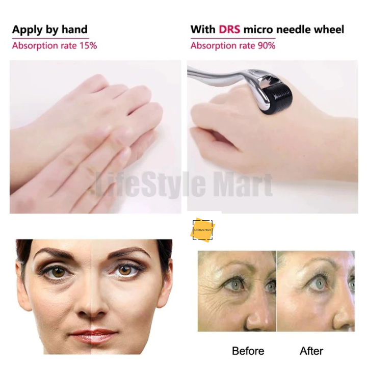 Facial%20Microneedle%20Derma%20Roller%20System%20Black%200.25mm%20-%20Image%204