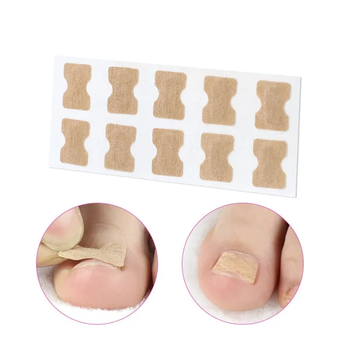 Ingrown%20Toenail%20Corrector%20Stickers%20Paronychia%20Treatment%20Pedicure%20Toe%20Nail%20Care%20Corrector%20Patch%20Correction%20Stickers%2010-50Pcs%20-%20Image%204