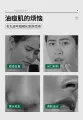 Salicylic acid Cream Remove Acne Blackhead Whitehead Invisible shrink pores  20g. 
