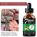 7DAYS Repair Nail Fungus Treatments Essence Foot Care Serum Toe Nails Fungal Removal Gel Anti-Infection Onychomycosis Care Tool. 