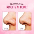 〽️ Bron Stick / Blackhead Remover Tool Acne Pimple Extractor (Silver) 1 pcs.