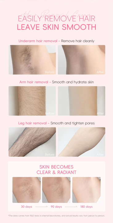 %E3%80%BD%EF%B8%8F%20LAIKOU%20Japan%20Sakura%20Hair%20Removal%20Cream%20-%2050g%20-%20Image%204