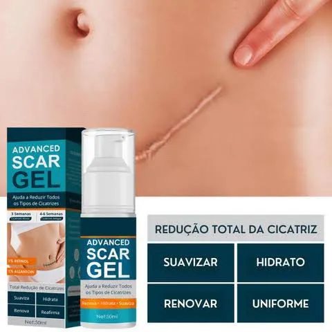 Jaysuing%20Advanced%20Scar%20Gel,%20Scar%20Removal%20for%20Surgical%20Scars,%20Acne%20Scar%20Removal%20Cream-50gm%20-%20Image%202