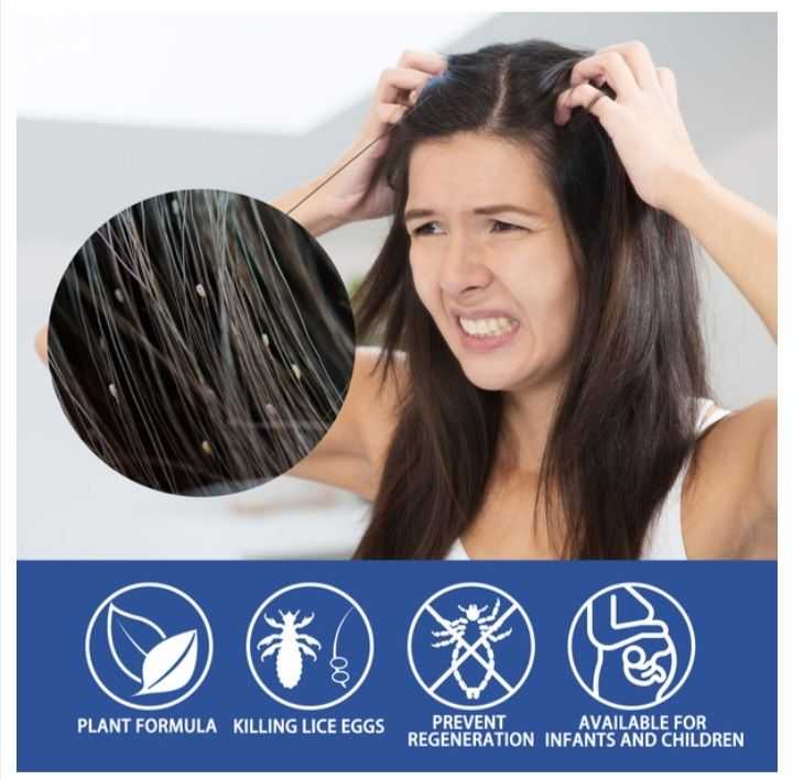 Lice%20Removal%20Spray%20For%20Kids%2030ml%20Rid%20Lice%20Spray%20Lice%20Scaring%20Spray%20Hair%20Repel%20Lice%20Daily%20Lice%20Prevention%20Conditioning%20Spray%20Made%20in%20china%20-%20Image%202