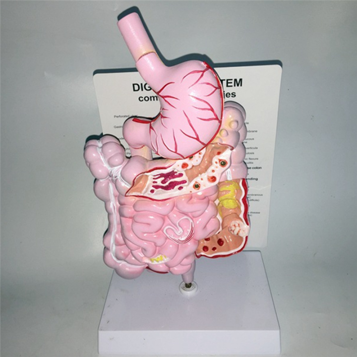 Internal Organs Structure Model Human Digestive System Stomach ...