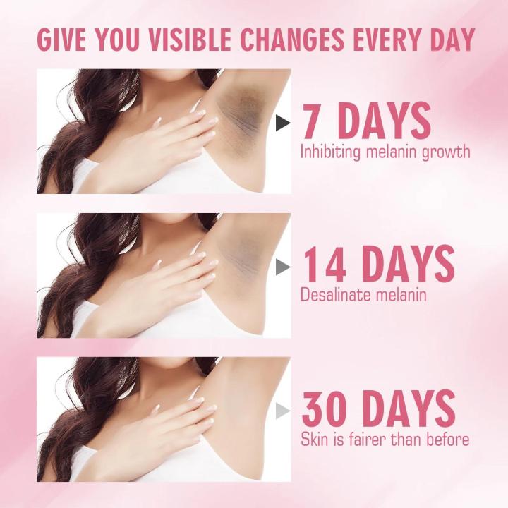 Body%20Bleaching%20Cream%20Brighten%20Dark%20Intimate%20Private%20Parts%20Knees%20Thigh%20Inner%20Joint%20Bikini%20Remove%20Melanin%20Underarm%20Whitening%20Cream%20-%20Image%206