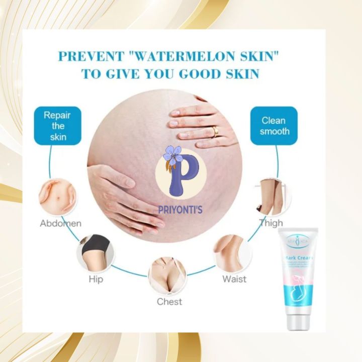 Aichun%20Beauty%20Anti%20Stretch%20Mark%20Cream%20%E2%80%93%20Intensive%20Skin%20Treatment%20for%20Improvement%20&%20Elimination%20-%20Image%205