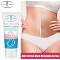 Aichun Beauty Anti-Stretch Marks Cream | Stretch Marks Removal Cream 60g. 