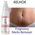 EELHOE Scar Removal Cream Gel Burn Surgical Scar Cesarean Scar Repairing Stretch Marks Pigmentation Corrector. 