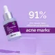 The Derma Co 10% Niacinamide Face Serum For Acne Marks And Acne Prone Skin For Men and Women-30 ml(dermaco). 