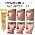 LANBENA TCM scar and Acne Spot Removal Gel Ointment. 