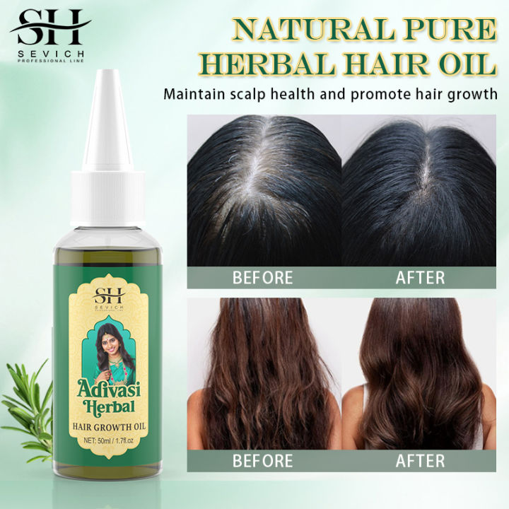 Ayurvedic%20Hair%20Growth%20Oil%20India%20Adivasi%20Organic%20Hair%20Growth%20Serum%20Anti%20Hair%20Loss%20Fast%20Regrowth%20Thicken%20Oils%20Hair%20Growth%20Products%20FeeoiF%20-%20Image%204