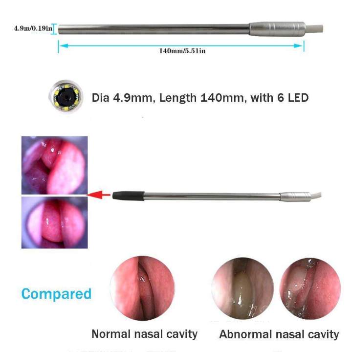 5mm%20Lens%20Android%20OTG%20USB%20/%20PC%20USB%20LED%20Endoscope%20Camera%20Inspection%20Borescope%20Camera%20For%20Ear%20Nose%20Mouse%20-%20Image%203