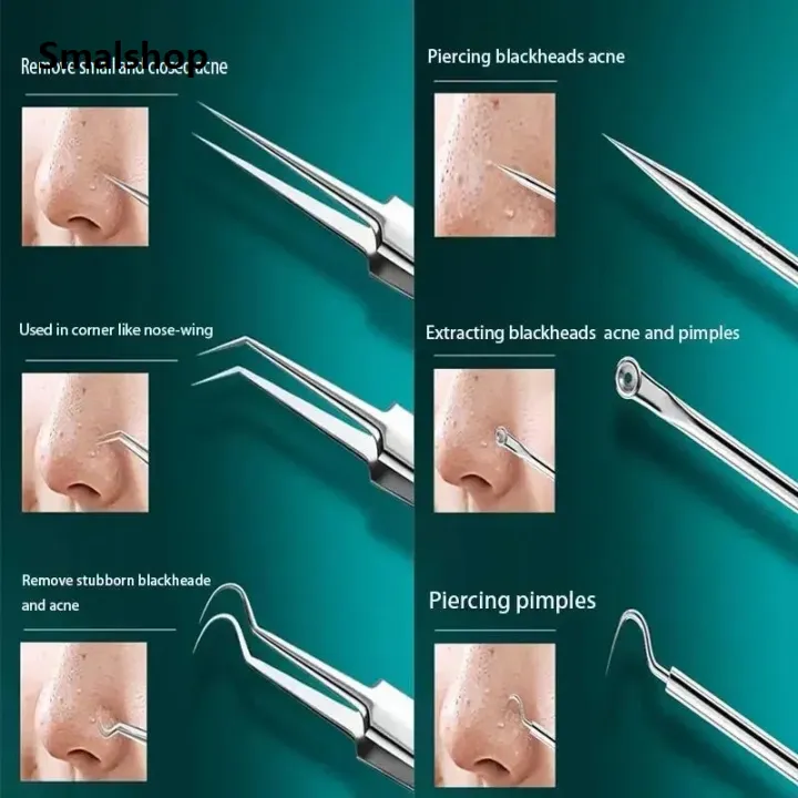 11Pcs/Set%20Acne%20Needle%20Blackhead%20Clip%20Remover%20Extraction%20Pore%20Black%20Head%20Cleaner%20Face%20Skin%20Care%20Cleansing%20Needle%20Tool%20Cell%20Clamp%20-%20Image%205