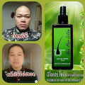 120ml Original Neo Hair Lotion Made In Thailand Natural Essence Prevents Hair Loss Scalp Treatment For Man Woman Hair Growth Oil BruberryBeE.