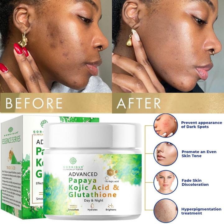 Best Kojic Acid Cream Skin Nourishing Resurfacing Fade Cream skin care face  cream bioaqua acne creme | Daraz.com.bd
