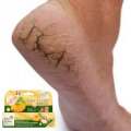 Bio Active Banana & Argan Oil Cracked Heel & Foot Balm - 30ml. 