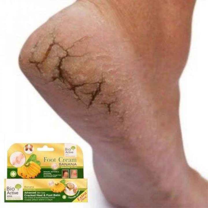 Bio%20Active%20Banana%20&%20Argan%20Oil%20Cracked%20Heel%20&%20Foot%20Balm%20-%2030ml%20-%20Image%203