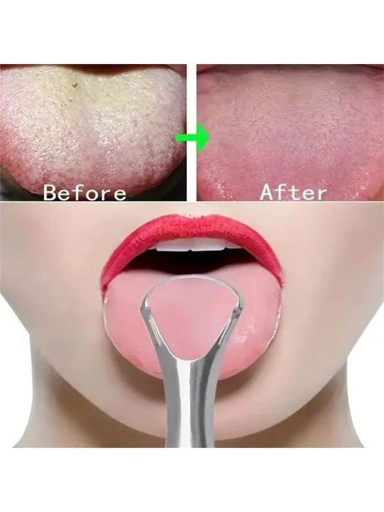 Tongue%20Scraper%20Cleaner%20for%20Adults%20Double-sided%20tongue%20scraper%20-%20Image%203