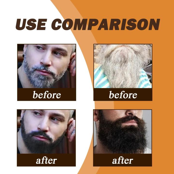 Darkening%20Shampoo%20Gray%20To%20Black%20For%20Men%20Women%20Anti%20Dandruff%20Removal%20White%20Hair%20Moustache%20Coloring%20Shine%20Smooth%20Hair%20Dye%20Shampoo%20-%20Image%204