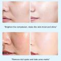 Whitening Cream For Face Spots Remove Dark Spot Melasma Anti-Pigmentation Improve Dullness Brighten Face Skin Care Cream. 