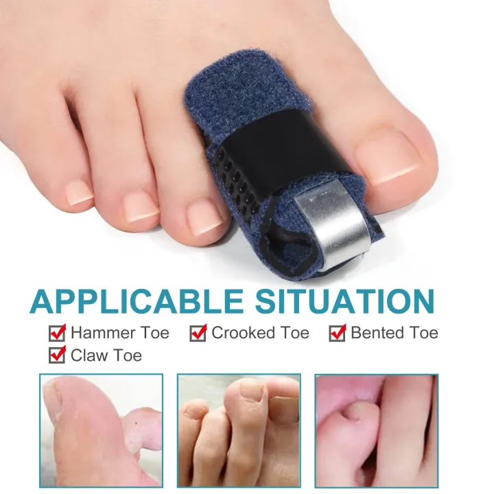 Toe%20Splint%20Broken%20Finger%20Sprain%20Joint%20Immobilization%20Fracture%20Pain%20Relief%20Finger%20Support%20Brace%20Thumb%20Protector%20Camel%20Toe%20Care%20-%20Image%203