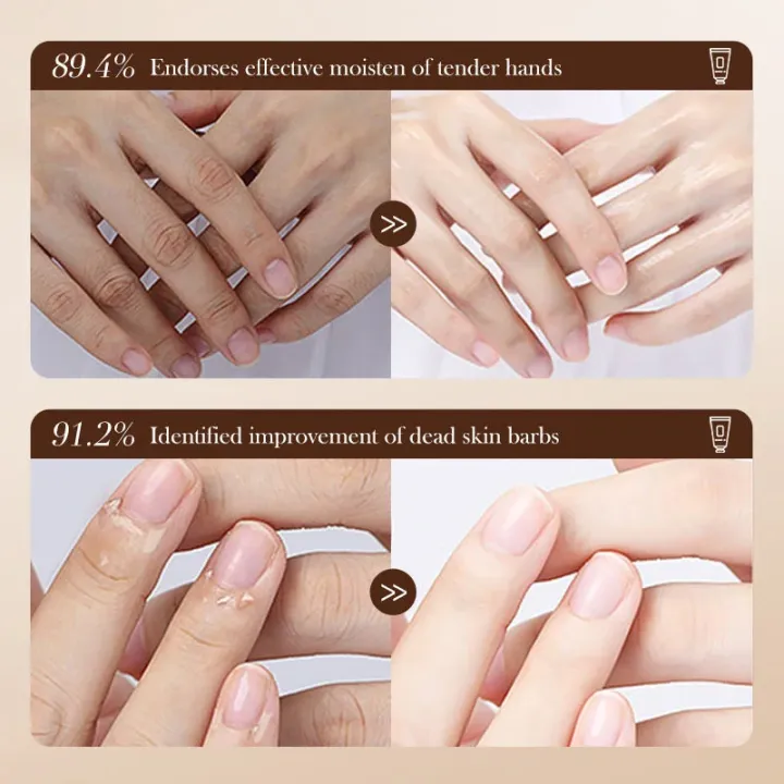 %E3%80%BD%EF%B8%8F%20FAYANKOU%20Fruit%20Botanical%20Hand%20Cream%20Set%20%E2%80%93%2030g%20x%205%20pieces%20%7C%20Hydrating%20Hand%20Cream,%20Moisturizing%20Fruit%20Extract%20&%20Skin%20Brightening%20Hand%20Care%20for%20Soft%20&%20Elastic%20Hands%20%7C%20By%20Muin%20Distribution%20-%20Image%204