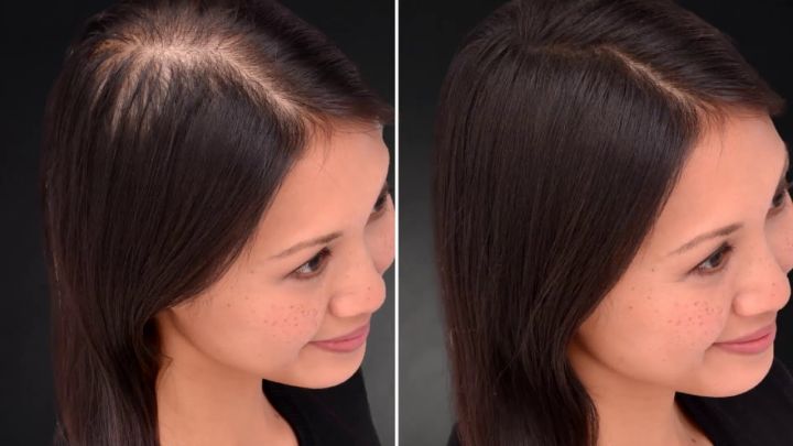 Pack%20of%202%20Toppik%20Hair%20Building%20Fiber%20Black%2027.5%20gm%20-%20Image%204