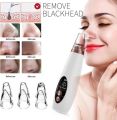 Rechargeable Electric Blackhead Remover Device. 