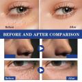 Fat Granules Removal Eye Serum Eye Milia Repair Treatment Products Wrinkle Lifting Moisturizing Anti-Puffiness Korean Skin Care.