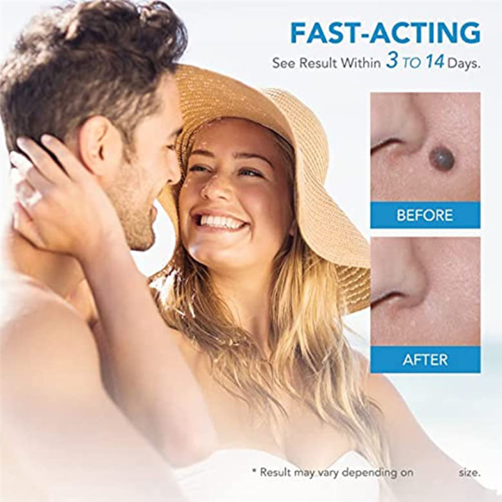 %E3%80%90WSJJ%20Store%E3%80%91%EF%BC%88NEW%EF%BC%892%20In1%20Painless%20Auto%20Skin%20Tag%20Mole%20t%20Removal%20Kit%20Skin%20Care%20t%20Dot%20Treatments%20Remover%20Cleaning%20Tools%20Double%20Head%20t%20Removal%20Tool%20Set%20-%20Image%204