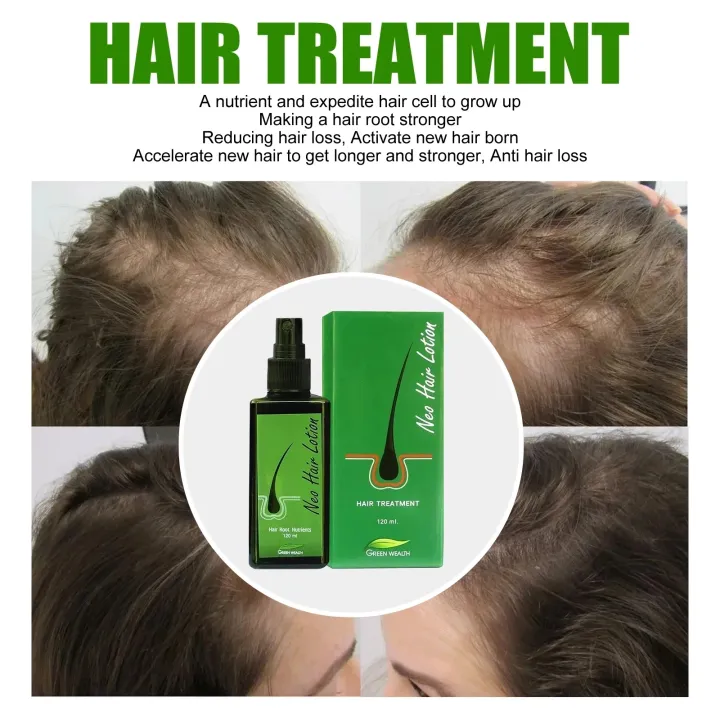 3PCS%20Natural%20Thailand%20Neo%20Hair%20Lotion%20Hair%20Care%20Oil%20Hair%20Grow%20Serum%20Essential%20Hair%20Loss%20Treatment%20Product%20Hair%20Growth%20120ML%20Lateil%20-%20Image%204