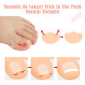8 Pack Ingrown Toenail Corrector Sticker Paronychia Treatment Fixer Restoration Pedicure Elastic Sticker Foot Toe Nail Care Tool.