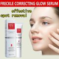 Whitening Freckle Cream Effective Remove Melasma Cream Remove Dark Spots Melanin Moisturize Brighten Smooth Face Skin Care.