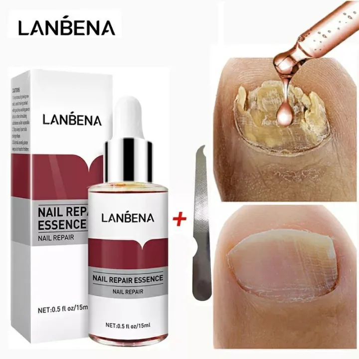 LANBENA%20Nail%20Repair%20Essence%20-%2015ml%20-%20Image%206
