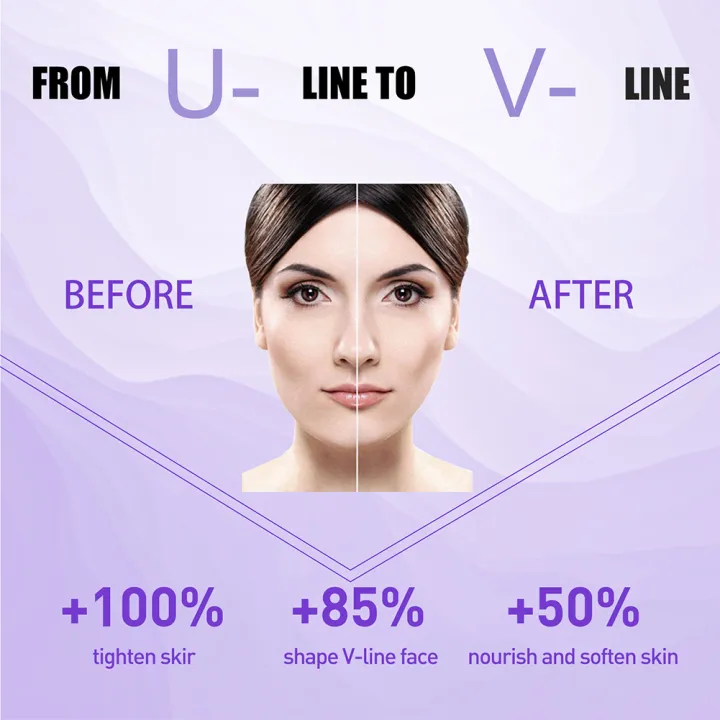 V-Shape%20Slimming%20Cream%20Skin%20Tightening%20Cream%20Face%20Slimming%20Cream%20for%20Tightening%20Skin%20Double%20Chin%20Removal%20-%20Image%206