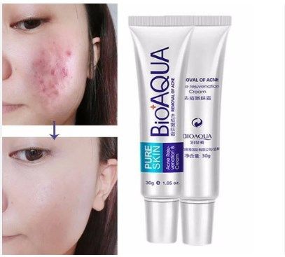 Bioaqua Pure Skin Acne Removal & Rejuvenation Cream -30gm