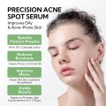 LANBENA Salicylic Acid Acne Spot Serum Cleanses Pores And Reduces Acne Oil Control Brightening Skin Acne Treatment Serum 10ml. 