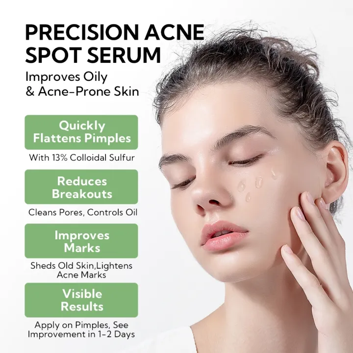LANBENA%20Salicylic%20Acid%20Acne%20Spot%20Serum%20Cleanses%20Pores%20And%20Reduces%20Acne%20Oil%20Control%20Brightening%20Skin%20Acne%20Treatment%20Serum%2010ml%20-%20Image%204