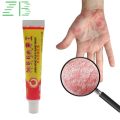 2pcs Natural Psoriasis Ointment Tinea Pedis Antibacterial Antipruritic Dressing Treat Dermatitis Eczema Skin Repair Care Cream. 