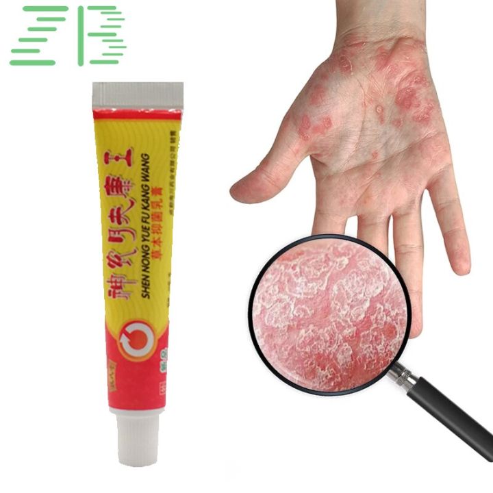 2pcs%20Natural%20Psoriasis%20Ointment%20Tinea%20Pedis%20Antibacterial%20Antipruritic%20Dressing%20Treat%20Dermatitis%20Eczema%20Skin%20Repair%20Care%20Cream%20-%20Image%204