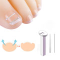 Ingrown Toenail Corrector Tools Pedicure Recover Embed Toe Nail Treatment Professional Ingrown Toenail Correction Foot Care Tool MIRRORRR. 