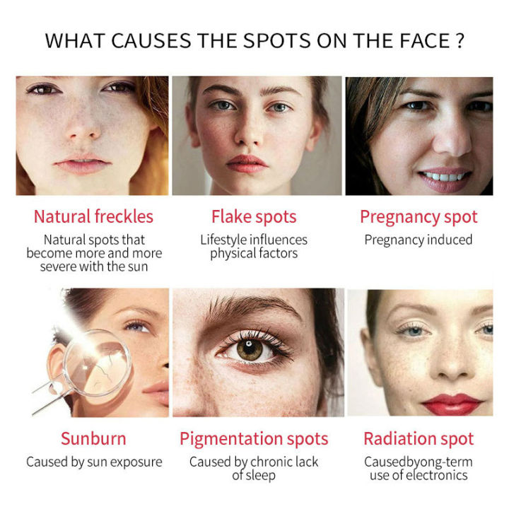 Dimollaure%20Whitening%20Freckle%20Cream%20Moisturize%20Firming%20Anti-Wrinkle%20Remove%20Dark%20Spots%20Melasma%20Melanin%20Bright%20Face%20Korea%20Skin%20Care%20-%20Image%205