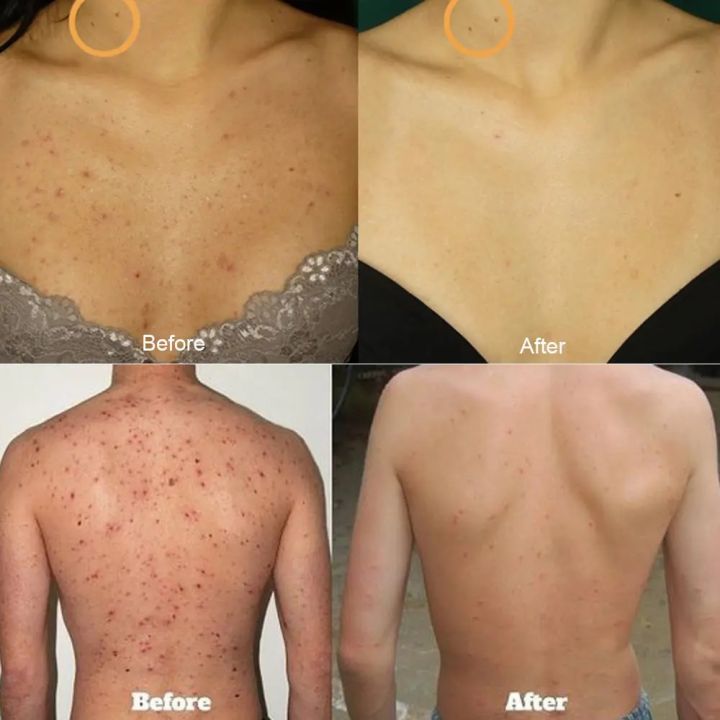 Sea%20Salt%20Soap%20Exfoliating%20Acne%20Treatment%20Deeply%20Goat's%20Milk%20Soap%20Body%20Whitening%20Cleaner%20Pores%20Blackheads%20Removal%20Makeup%20Tools%20-%20Image%203