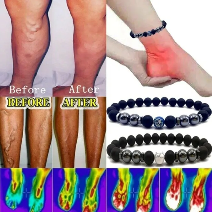 Anti-Swelling%20Black%20Obsidian%20%20Stone%20Anklet%20Adjustable%20Weight%20Loss%20Magnet%20Bracelets%20Anklet%20for%20Women%20Men%20-%20Image%205