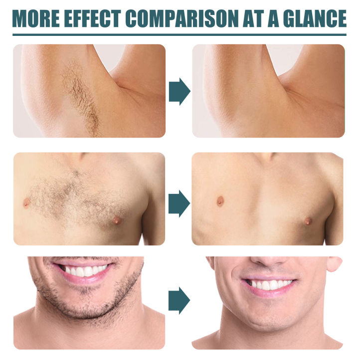 50g%20Beard%20Removal%20Cream%20Painless%20Fast-acting%20Mustache%20Supplies%20Men%20Use%20Facial%20Hair%20Beard%20Remover%20for%20Male%20Chest%20Remover%20-%20Image%205