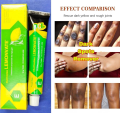 Lemonvate Cream 30 Gms.