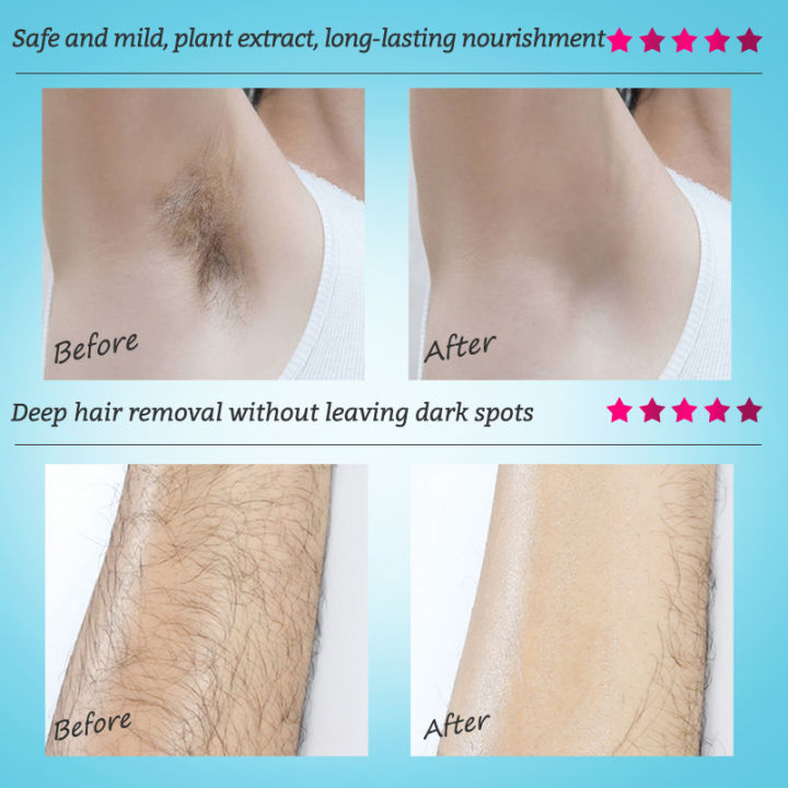 RtopR%20Mango%20Body%20Hair%20Removal%20Cream%20Hand%20Leg%20Hair%20Loss%20Cream%20Removal%20Armpit%20Hair%20Remover%20Cream%2040g%20-%20Image%206